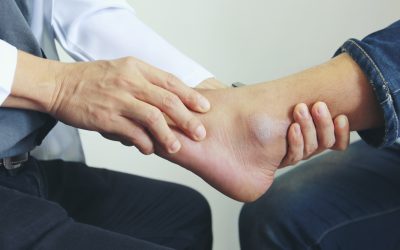 Tingling in the Feet: Diagnosis and Treatment of Diabetic Neuropathy